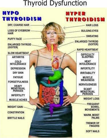 thyroid-dysfunction