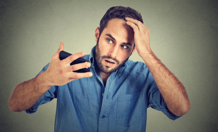 Dealing with Baldness and Acne