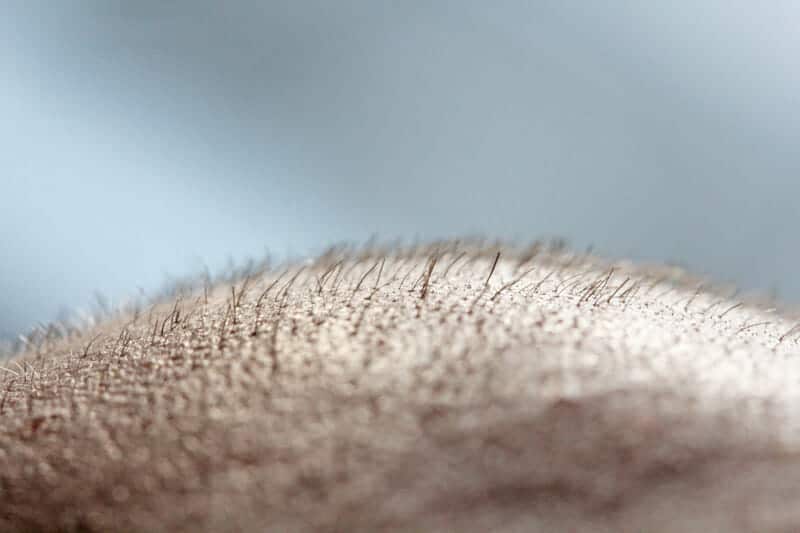 Auxano Grow vs. Other Hair Loss Treatments: Who Wins?