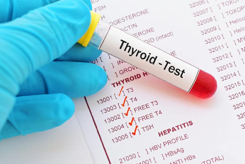 Desiccated Thyroid