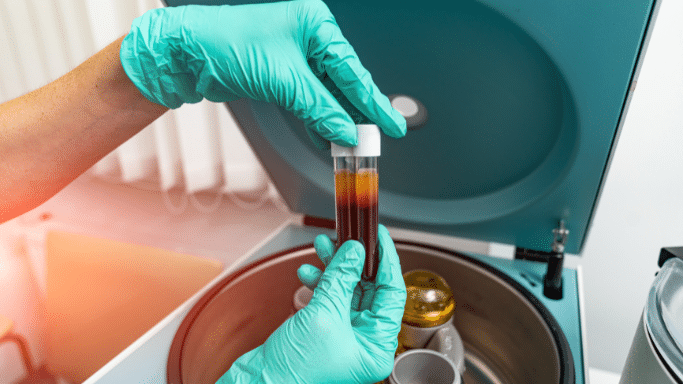 A top-down view of a person wearing teal medical gloves holding two glass test tubes. The tubes contain blood that has been separated by a centrifuge, showing a dark red layer at the bottom and a yellowish plasma layer at the top.