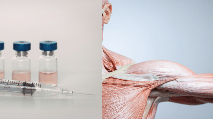 A split-screen graphic. The left side shows three glass vials with blue caps containing clear liquid and a syringe in the foreground. The right side is a detailed anatomical illustration of a human neck and shoulder, revealing the complex layers of muscles, tendons, and ligaments.