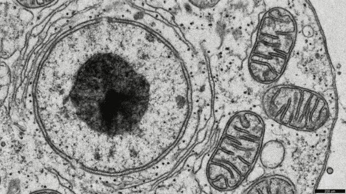 Black-and-white electron micrograph of a cell showing a large nucleus with a dark nucleolus and several mitochondria with visible cristae.