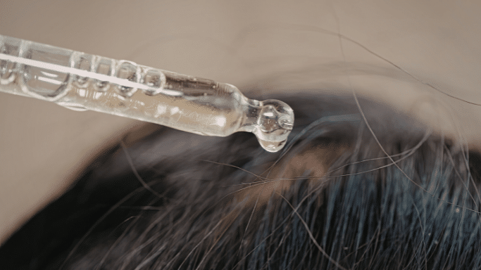 A close-up shot of a glass dropper hovering over a person's dark hair, releasing a single drop of clear treatment oil onto the scalp.