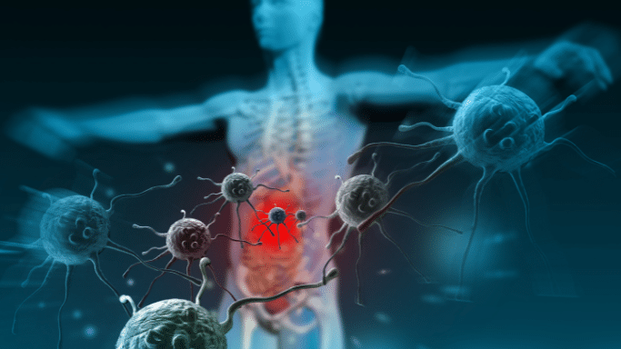 A conceptual medical graphic showing a translucent blue human silhouette in the background. In the foreground, several dark, spiky spherical cells are linked together, with a prominent red glow emanating from the abdominal region of the silhouette.