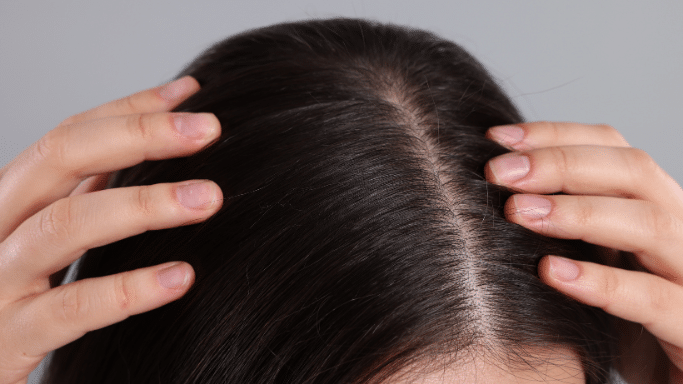 A close-up, top-down view of a person's scalp and dark brown hair. Two hands are parting the hair to show the scalp clearly, often used to demonstrate hair density or scalp health.