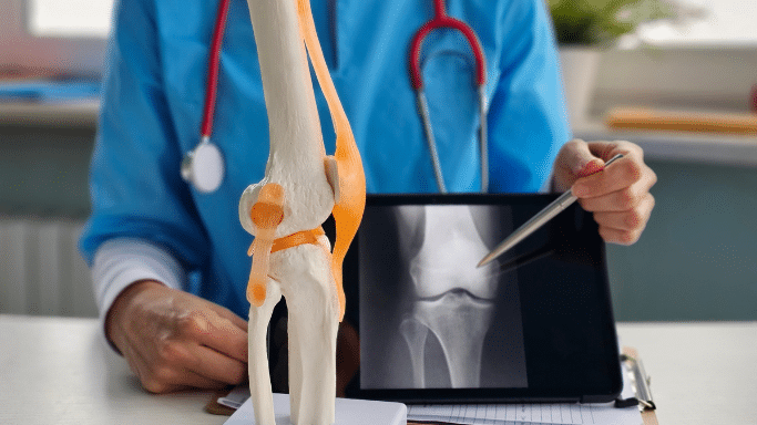 A doctor in blue scrubs sits behind a desk. In the foreground is a physical anatomical model of a knee joint. The doctor is using a silver pen to point at an X-ray of a knee displayed on a digital tablet.