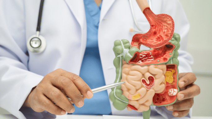 A close-up of a healthcare provider pointing a silver pen at an anatomical model of the human digestive system, specifically highlighting the intestinal tract.