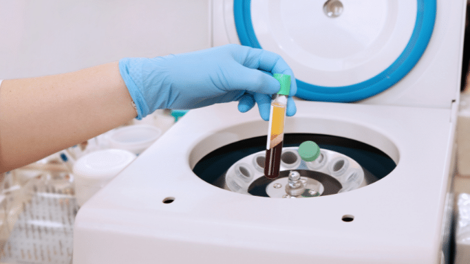 A close-up shot of a person's hand wearing a blue latex glove, lifting a clear plastic test tube out of a white laboratory centrifuge machine. The test tube contains a separated blood sample, clearly showing distinct layers of dark red red blood cells at the bottom and a thick, yellowish plasma layer at the top.
