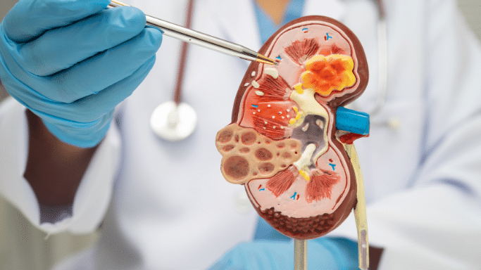 A close-up of a doctor wearing blue medical gloves pointing a metallic pen at an anatomical model of a human kidney, highlighting its internal structure and cross-section details.