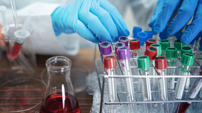 A close-up of a researcher's gloved hands organizing a rack of colorful medical test tubes. A glass flask containing a red liquid is in the foreground, with other lab equipment blurred in the background.