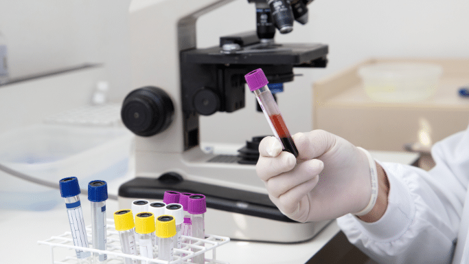 A person wearing white lab gloves holds up a glass test tube filled with dark red blood. In the background, a laboratory microscope is visible, along with a rack containing several other color-coded specimen tubes.