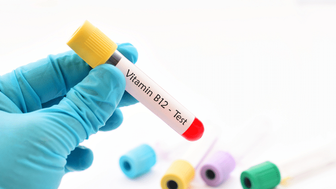 A hand in a blue nitrile glove holds up a glass medical test tube filled with a blood sample. The tube features a yellow cap and a white label that reads "Vitamin B12 - Test." Other blurred, multi-colored test tube caps are visible in the background.
