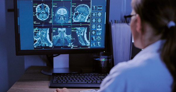 An over-the-shoulder view of a female medical professional with her hair tied back, looking at a large computer monitor displaying multiple MRI brain and spine scans. The room is dimly lit with a blue hue, and a keyboard sits on the desk in front of her.