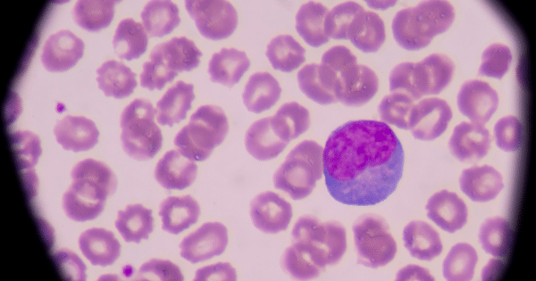 A microscopic view of a blood smear sample showing numerous pale purple, circular red blood cells spread across the field.