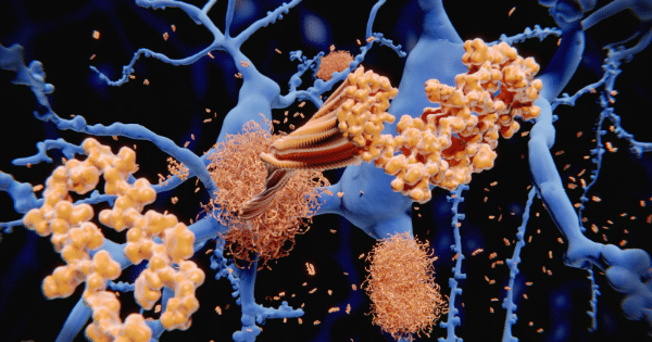 A microscopic 3D medical illustration showing blue, branching neuron structures against a dark background.