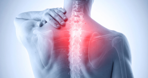 A medical 3D rendering of a human upper back and shoulders from behind, highlighting the skeletal structure of the spine and shoulder blades with a bright red glow centered along the upper spine and neck region.