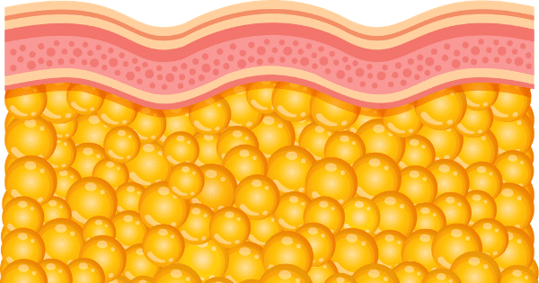 A flat vector illustration showing a cross-section of the skin, with pink upper skin layers and a thick lower layer densely packed with round, bright yellow fat cells.