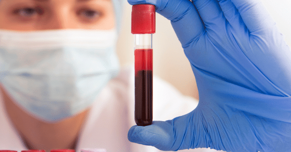 A lab technician wearing a face mask and blue nitrile gloves holding up a filled blood collection tube for inspection.