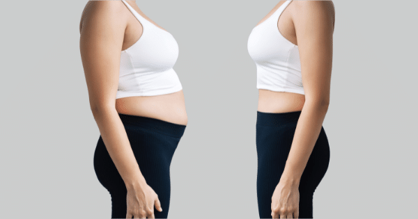 Side-by-side body profile comparison showing weight loss progress in a white top and black leggings.