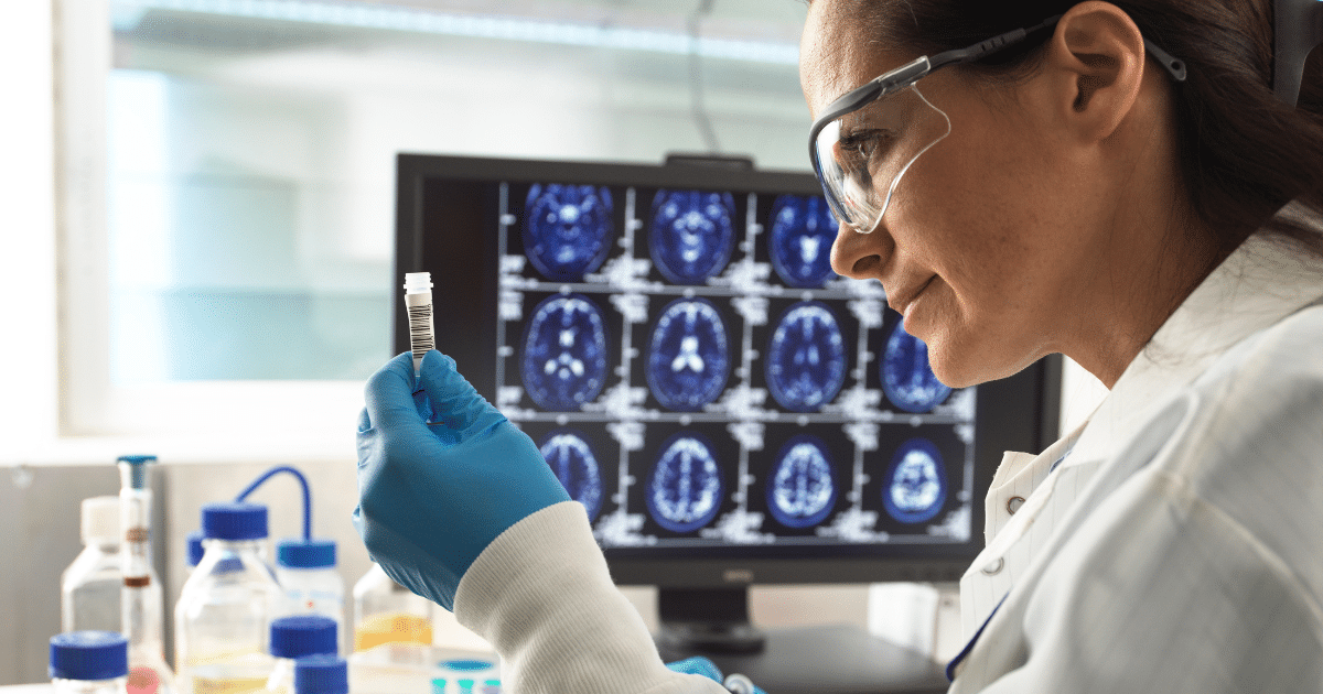 Side profile of a female scientist wearing safety glasses and blue gloves, closely inspecting a small vial with a barcode while a computer screen in the background displays a grid of brain MRI scans.