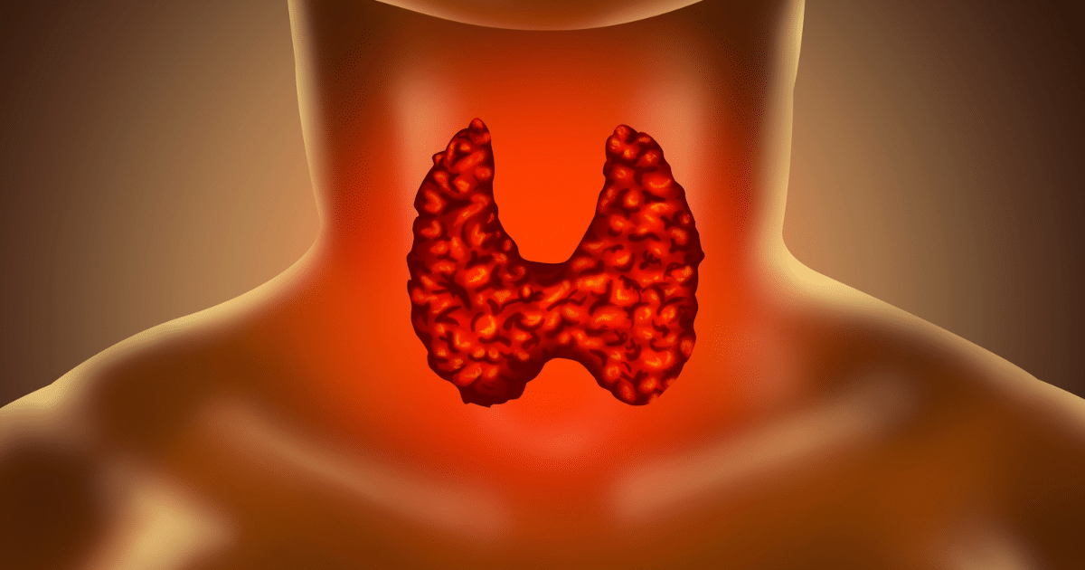 An anatomical illustration of the thyroid gland highlighted in red, situated in the throat area of a human silhouette.