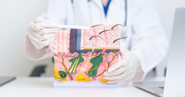 A gloved health professional pointing a white tool at a cross-section 3D model of human skin showing hair follicles, blood vessels, and skin layers.