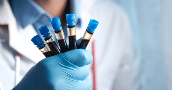 A gloved hand holds five blood collection tubes capped with blue lids, containing dark blood samples with visible plasma separation.