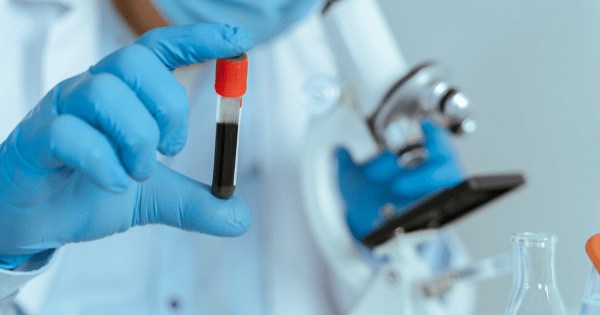 A person wearing blue rubber gloves holds up a red-capped blood collection tube in front of a white laboratory microscope.