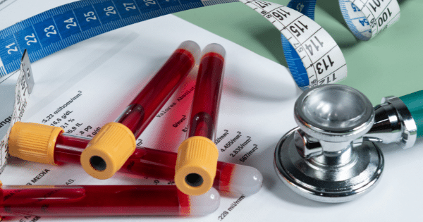 A collection of medical items lying over lab result papers, including blood sample collection tubes with yellow caps, a stethoscope, and flexible measuring tapes.