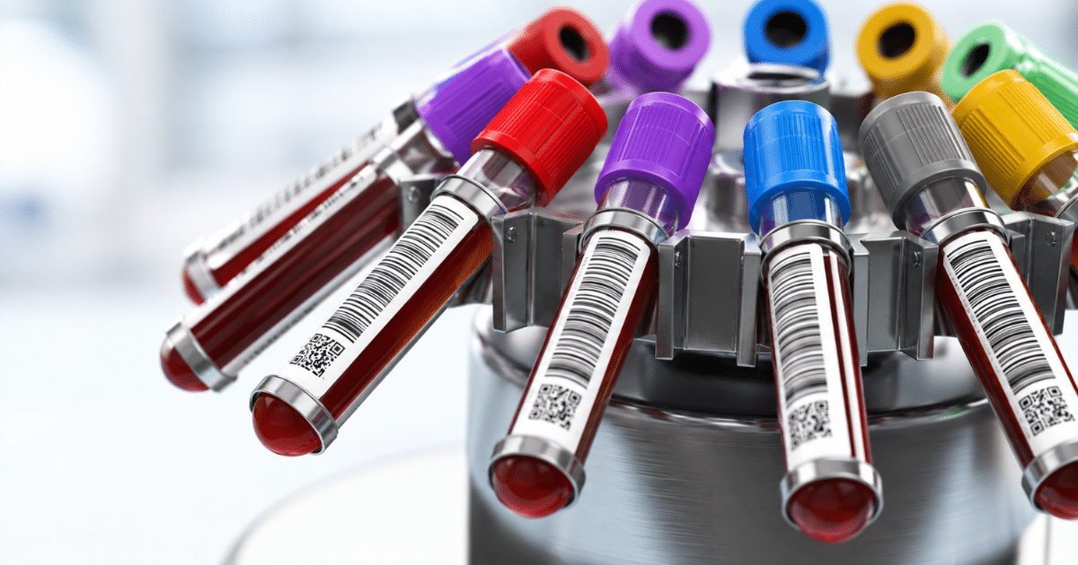 Multiple blood collection tubes with barcoded labels and colorful caps are arranged in a circular metallic laboratory centrifuge machine.