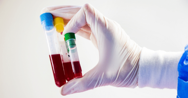 A gloved hand holding three blood sample collection tubes with different colored caps.