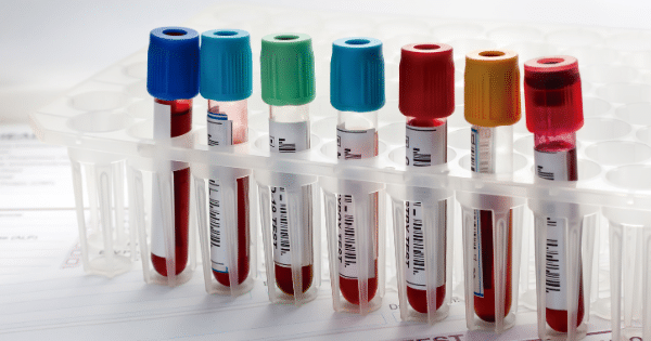 A set of medical test tubes containing blood samples with multi-colored caps (blue, green, red, yellow) arranged in a clear laboratory rack over paperwork.