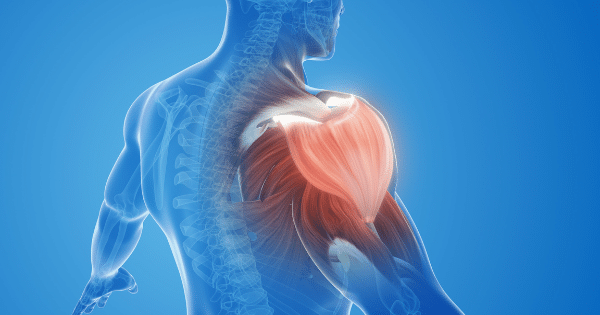 A 3D anatomical render of a human upper torso from the back quarter view, highlighting the shoulder and deltoid muscle group in glowing orange.