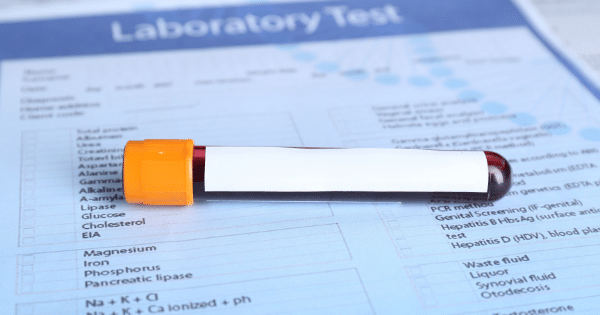 A blood sample collection tube with an orange cap lying on top of a medical laboratory test order form.