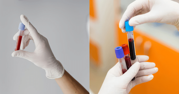A two-panel image showing gloved hands holding test tubes containing blood samples for testing.