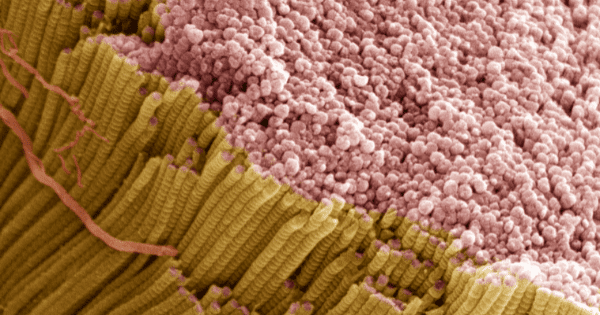 Microscopic close-up of pink round cellular structures adjacent to yellow ribbed fibers