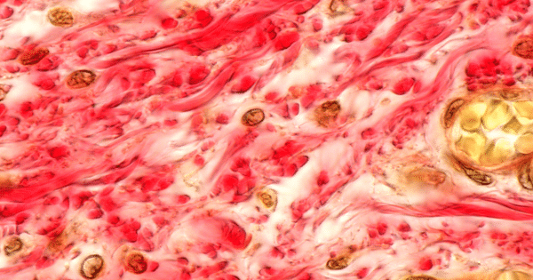 High-magnification biological view showing fibrous red tissue mixed with cellular structures.