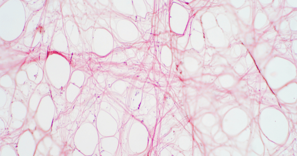 Histology slide view showing a pink web-like network of fibers and cells over a light background.