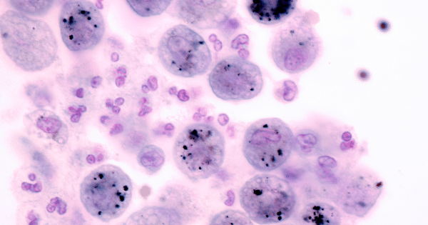 Microscopic view of stained purple cells with dark nuclei scattered across a light background.