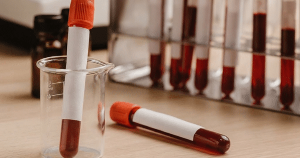 Blood collection tubes with red caps and blank labels sitting on a wooden surface near a test tube rack and beaker.