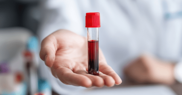 A close-up of a person holding out a blood collection tube with a red cap in their open hand.
