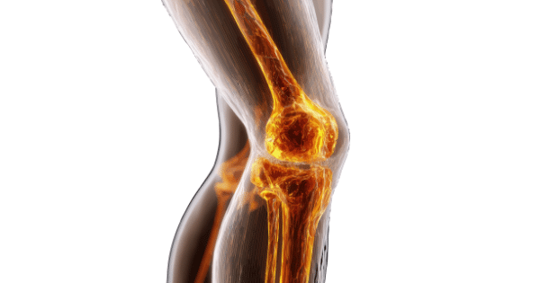 A 3D illustration highlighting glowing, translucent bones and the joint structure of a human knee.